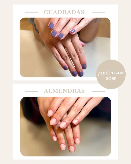 Instagram de Sense Bene: 🤷🏼‍♀️ ¿Qué TEAM sos? Comentá con A o B, la opción que más te represente 💃🏼

A. Team cuadradas 
B. Team almendras

🌸 Contanos en comenta